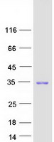 protp46527 p27 kip 1 cdkn1b human recombinant protein