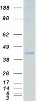 Coomassie blue staining of purified MAP2K3 protein
