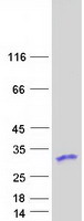 Coomassie blue staining of purified RPS5 protein