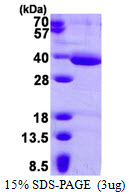 protp46952 sdspage human haa recombinant protein