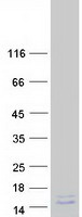 Coomassie blue staining of purified PCP4 protein
