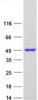 Coomassie blue staining of purified AMT protein