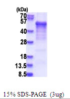 protp48730 sdspage human casein kinase 1 delta recombinant protein