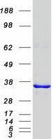 Coomassie blue staining of purified PITPNB protein