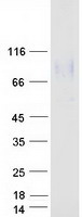 protp48960 cd97 adgre5 human recombinant protein