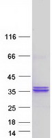 Coomassie blue staining of purified RPIA protein