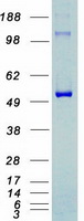 protp49336 cdk8 human recombinant protein