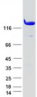 Coomassie blue staining of purified AMPH protein