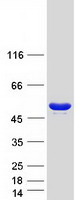 protp49591 sars human recombinant protein