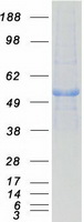 Coomassie blue staining of purified PPM1F protein