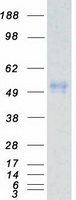 Coomassie blue staining of purified CSNK1E protein