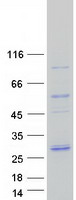 Coomassie blue staining of purified PSMB2 protein