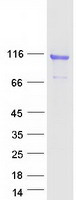 Coomassie blue staining of purified COMP protein