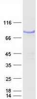 Coomassie blue staining of purified NUMB protein