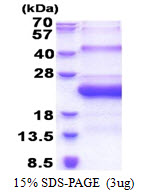 3ug by SDS-PAGE under reducing condition and visualized by coomassie blue stain.