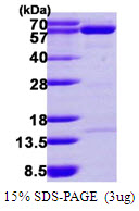 3ug by SDS-PAGE under reducing condition and visualized by coomassie blue stain