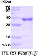 protp50135 sdspage human histamine n methyltransferase hnmt recombinant protein