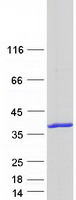 protp50226 sult1a2 human recombinant protein