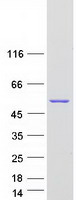 Coomassie blue staining of purified PPOX protein