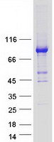 protp50416 cpt1a human recombinant protein
