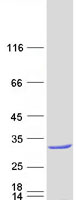 protp51157 rab28 human recombinant protein