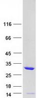 Coomassie blue staining of purified TPMT protein