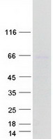 Coomassie blue staining of purified ARSD protein
