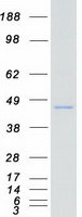 protp51817 prkx human recombinant protein