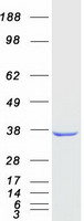 protp51857 akr1d1 human recombinant protein