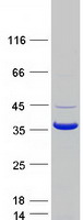 Coomassie blue staining of purified CNN1 protein