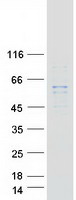 Coomassie blue staining of purified DGKE protein
