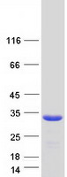 protp52565 rhogdi arhgdia human recombinant protein