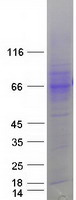 Coomassie blue staining of purified SLC7A2 protein