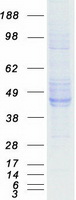protp52799 ephrin b2 efnb2 human recombinant protein