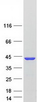Coomassie blue staining of purified AKR1C2 protein