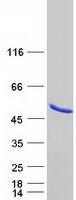 Coomassie blue staining of purified METAP1 protein