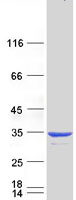 Coomassie blue staining of purified CRYBB1 protein