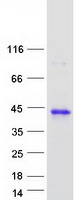 Coomassie blue staining of purified HCCS protein