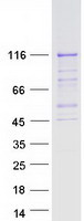 Coomassie blue staining of purified PMS2 protein