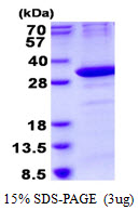 3ug by SDS-PAGE under reducing condition and visualized by coomassie blue stain.