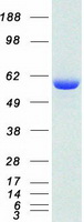 Coomassie blue staining of purified USP14 protein