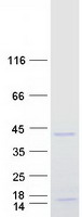 Coomassie blue staining of purified PRRX1 protein