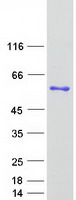 Coomassie blue staining of purified PSMD4 protein