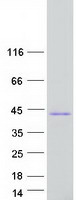 protp55042 rrad human recombinant protein