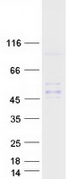 Coomassie blue staining of purified INHBC protein