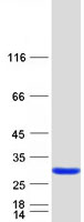 protp55327 tpd52 human recombinant protein