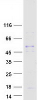 Coomassie blue staining of purified CCL18 protein