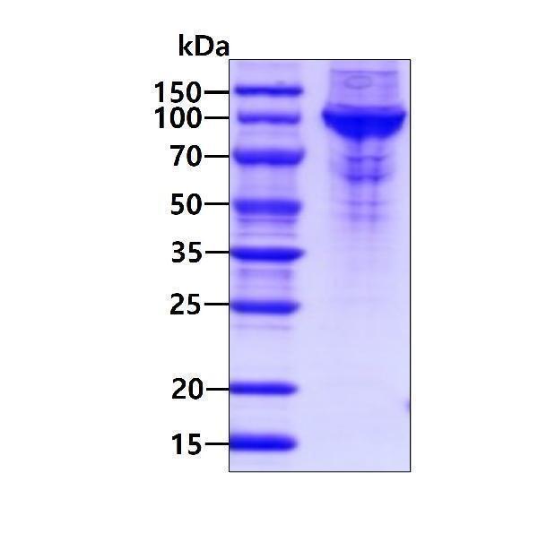 3ug by SDS-PAGE under reducing condition and visualized by coomassie blue stain