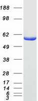 Coomassie blue staining of purified OXCT1 protein