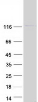 protp55884 eif3b human recombinant protein